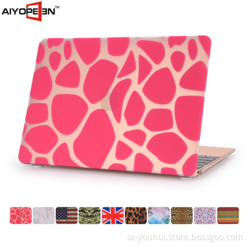 High quality and New Arrival Deer pink Stripes Covering Plastic Case for Macbook air /retina/pro 11/12/13/15 inch